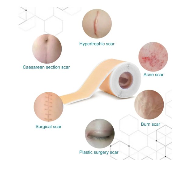 Parches Cintas Gel Silicona Para Cicatrices